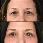 Masseur de luminothérapie rouge pour le contour des yeux